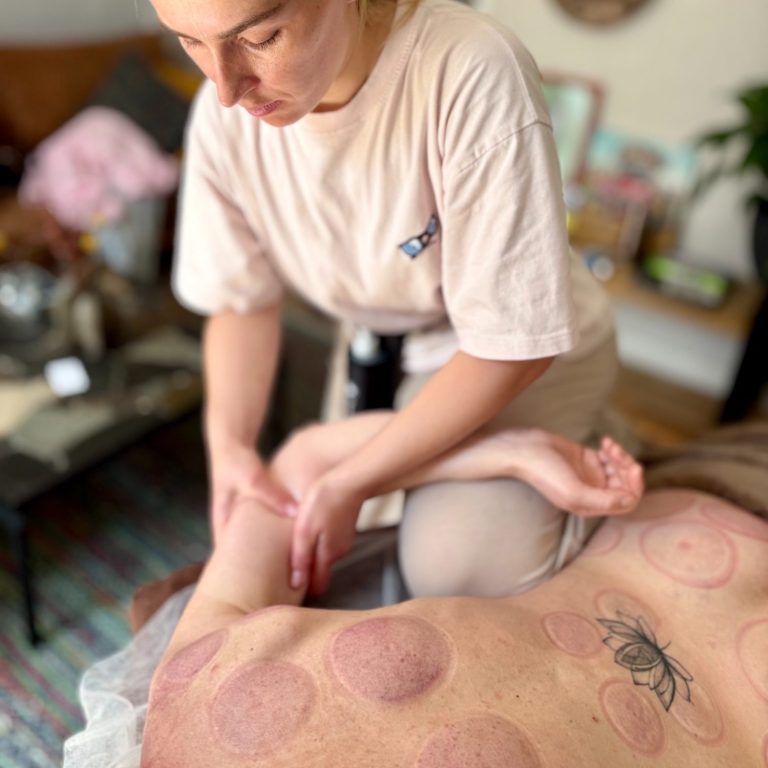 Zoya geeft een cuppingbehandeling